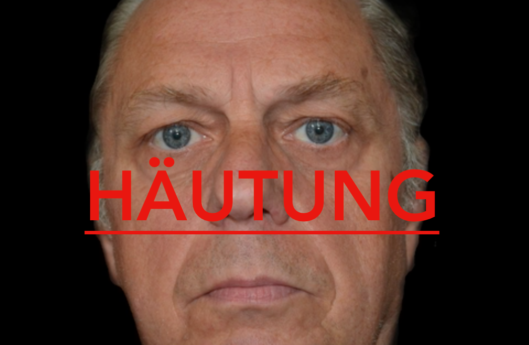 Read more about the article Häutung – Erweiterung des Einflussbereichs